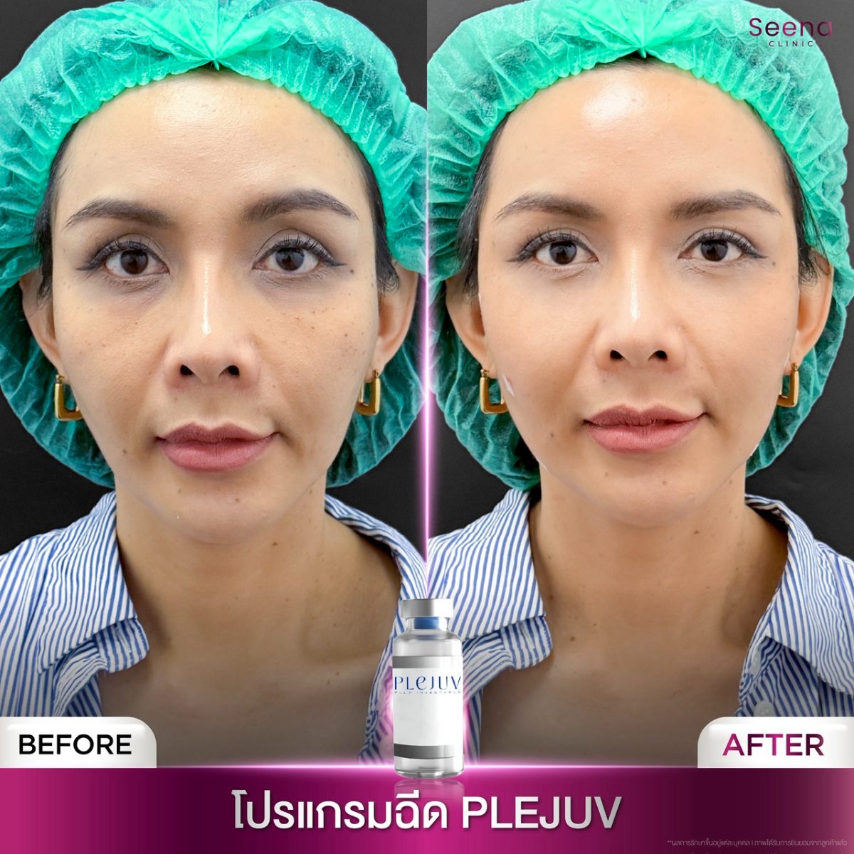 คุณน้อง ธัญญารัตน์