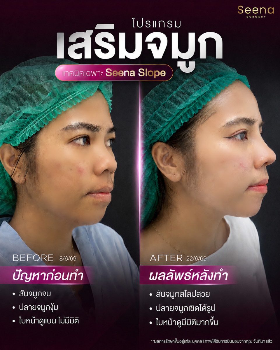 Surgery